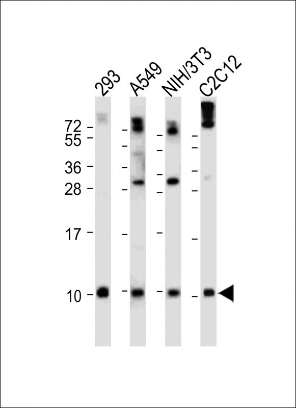 Rabbit Polyclonal Antibody to Ubiquitin (N-term)
