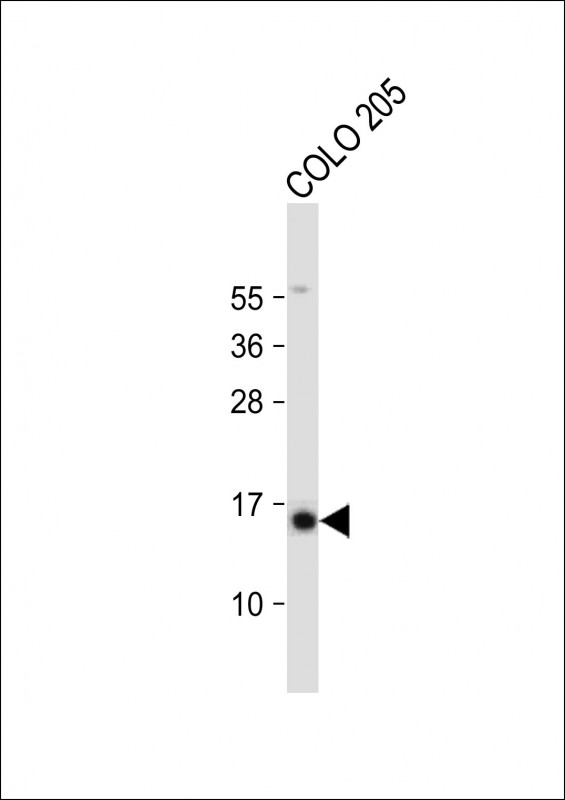 Rabbit Polyclonal Antibody to SNRPD3 (N-term)