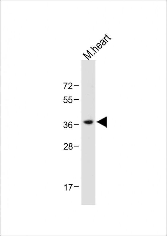 Rabbit Polyclonal Antibody to LPAR6