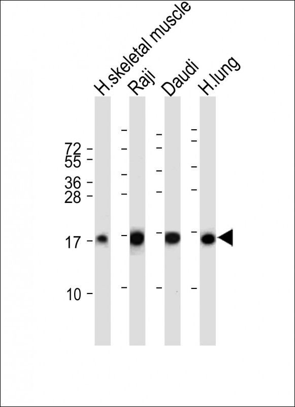 Rabbit Polyclonal Antibody to TSC22D3