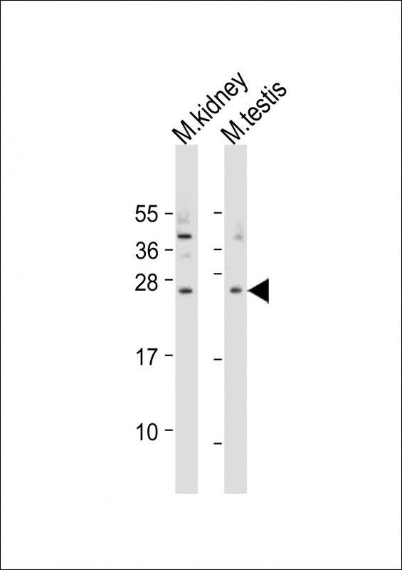 Rabbit Polyclonal Antibody to Mouse Trem2 (N-term)