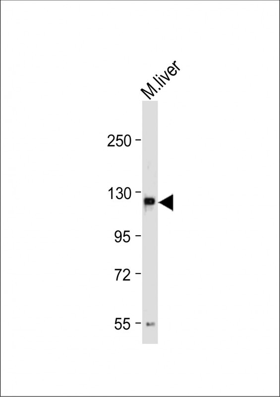 Rabbit Polyclonal Antibody to M Sema5a  (N-term)