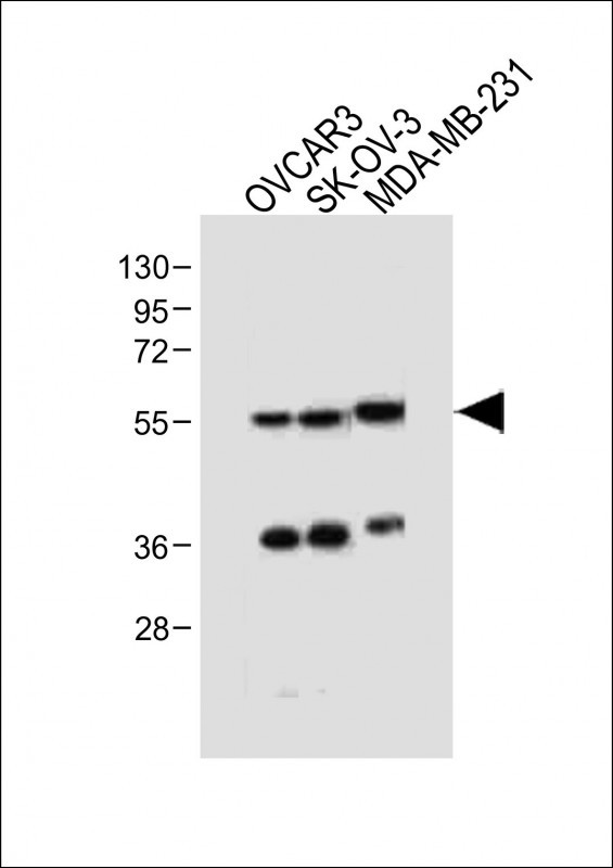 Rabbit Polyclonal Antibody to AMHR2 (N-term R80)