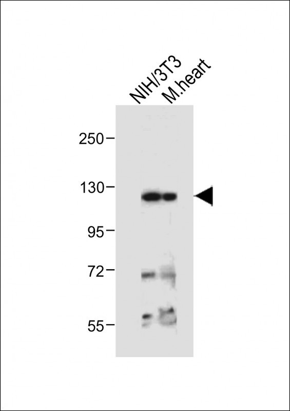 Rabbit Polyclonal Antibody to ROR1