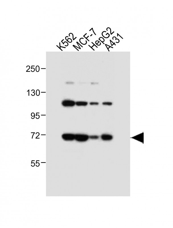 Rabbit Polyclonal Antibody to SMPD1