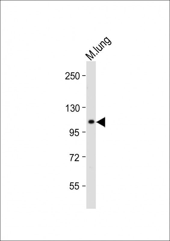 Rabbit Polyclonal Antibody to RHBDF2 (N-term)