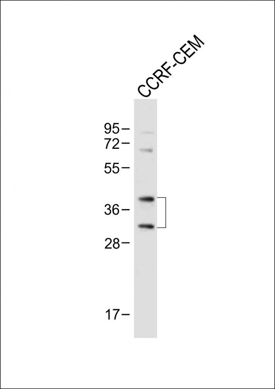 Rabbit Polyclonal Antibody to Mouse Nkx2-5