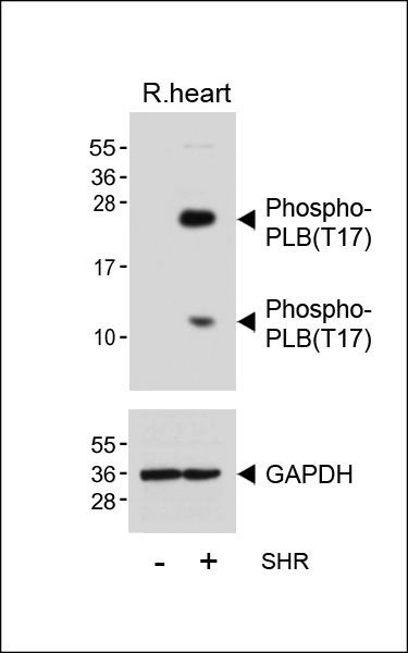Rabbit Polyclonal Antibody to Phospho-PLB(T17)