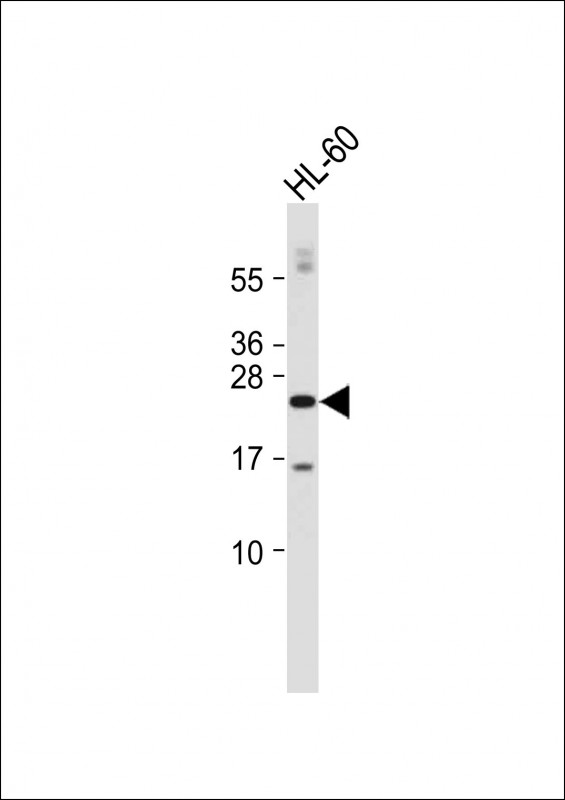 Rabbit Polyclonal Antibody to CDKN3