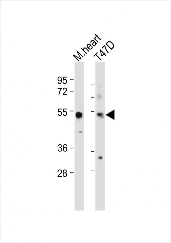 Rabbit Polyclonal Antibody to SCAR5  (C-term)