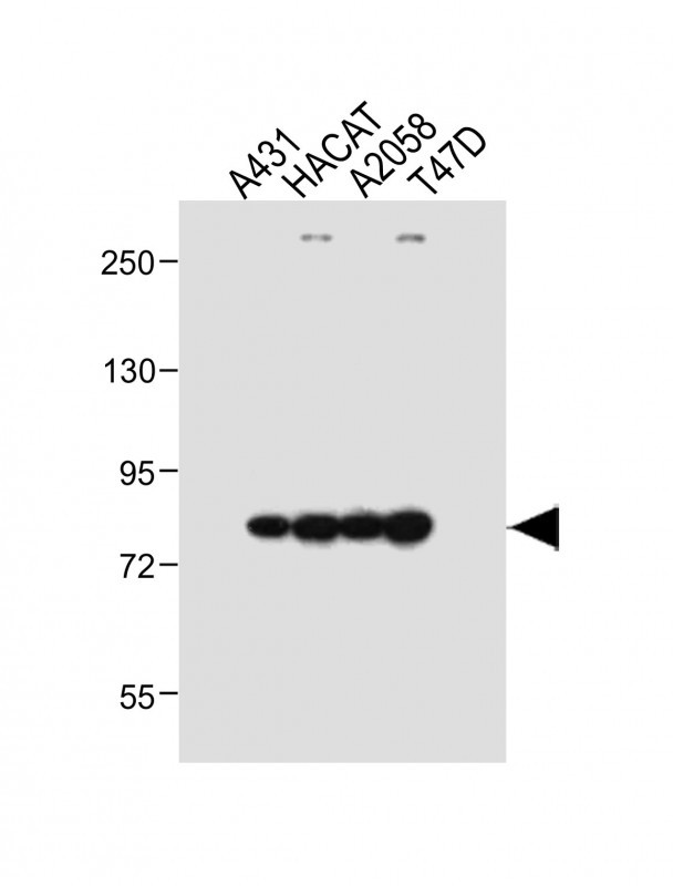 Rabbit Polyclonal Antibody to ALOXE3