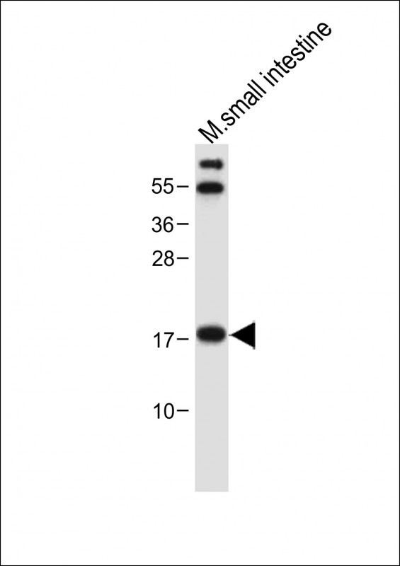 Rabbit Polyclonal Antibody to NUDT15