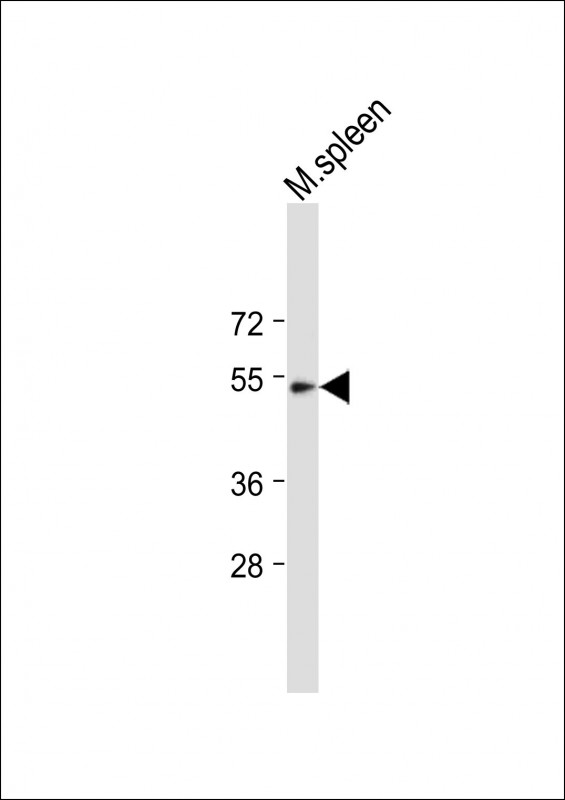 Rabbit Polyclonal Antibody to TBX6
