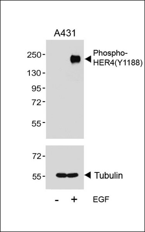 Rabbit Polyclonal Antibody to Phospho-HER4(Y1188)