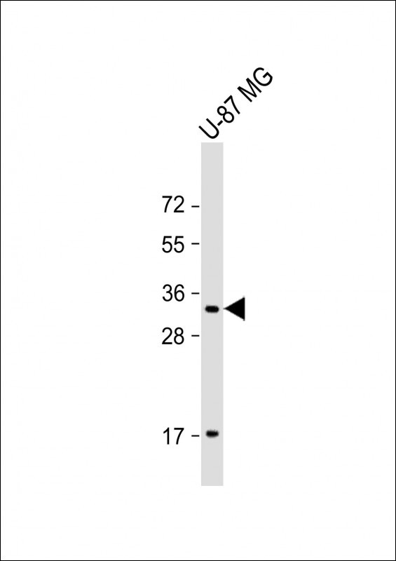 Rabbit Polyclonal Antibody to GGH (N-term)