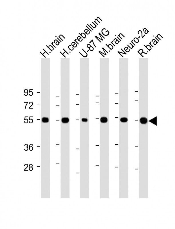 Rabbit Polyclonal Antibody to NRXN1 (N-term)