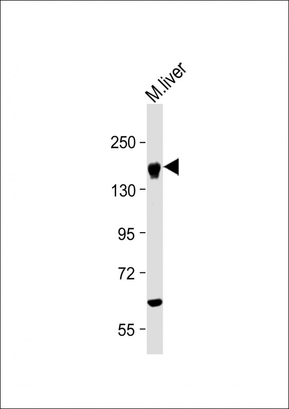 Rabbit Polyclonal Antibody to INSR(Insulin Receptor) (N-term)
