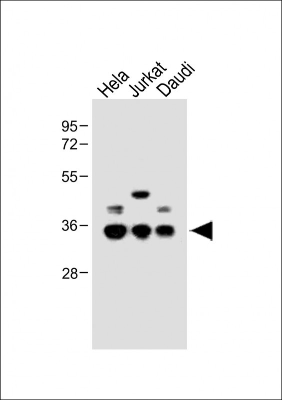 Rabbit Polyclonal Antibody to BCKDHB (N-term)