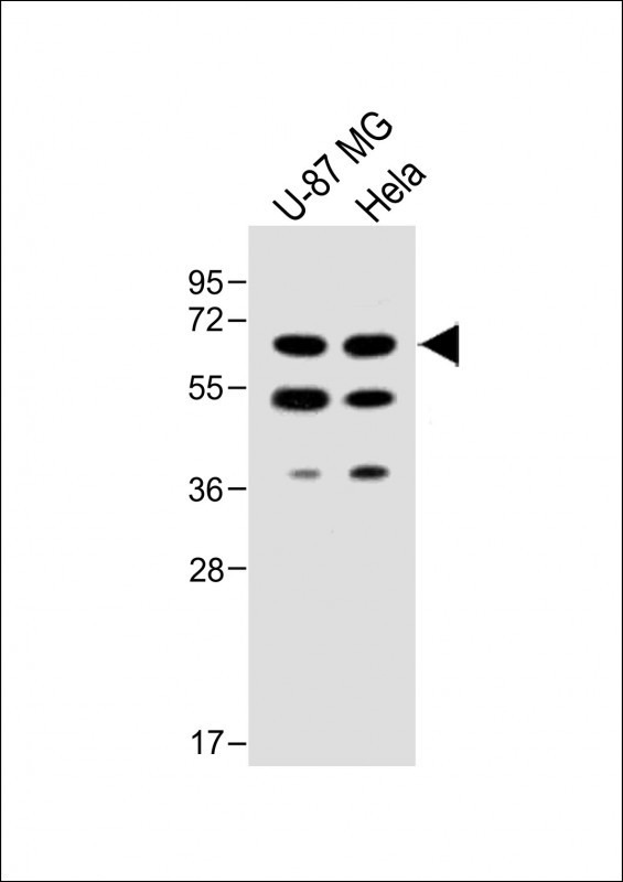 Rabbit Polyclonal Antibody to UGT8