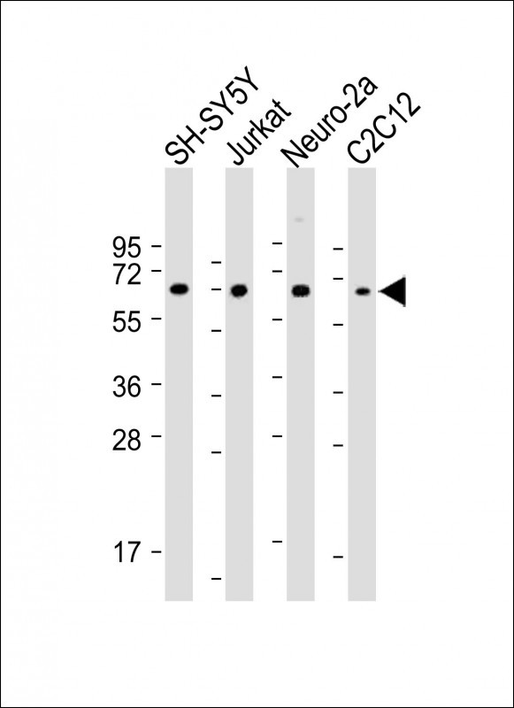 Rabbit Polyclonal Antibody to COL8A2