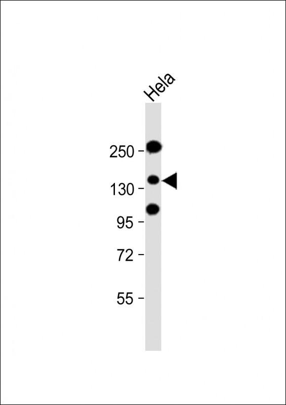 Rabbit Polyclonal Antibody to ZEB2