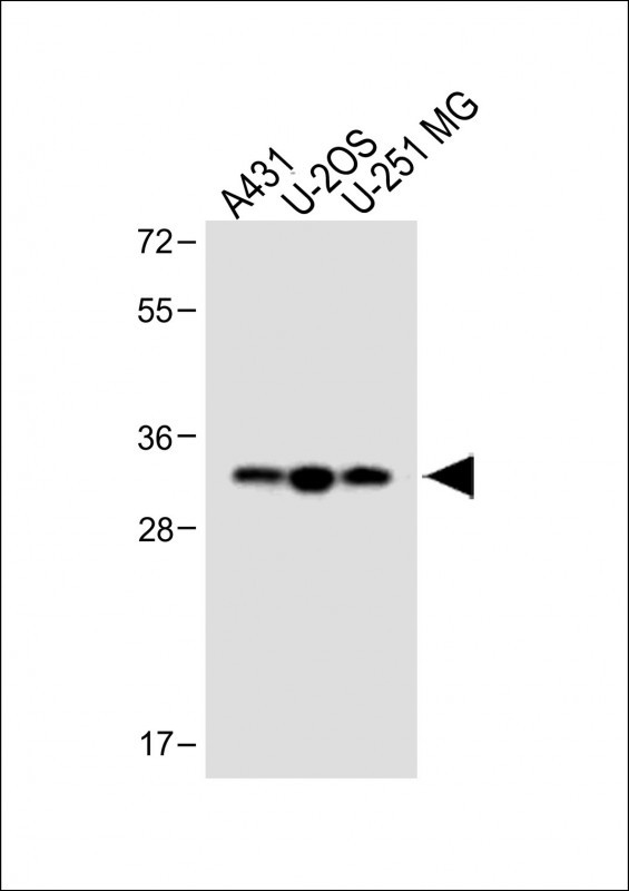 Rabbit Polyclonal Antibody to Stanniocalcin-2 (STC2) (N-term)
