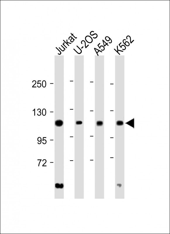 Rabbit Polyclonal Antibody to EXO1 (N-term)
