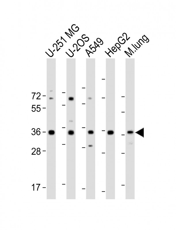 Rabbit Polyclonal Antibody to RCN3