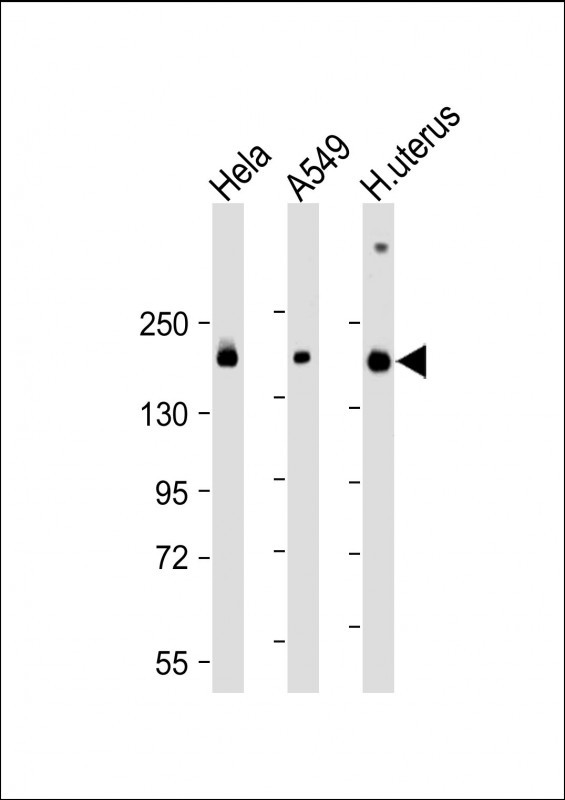 Mouse Monoclonal Antibody to ITGA11