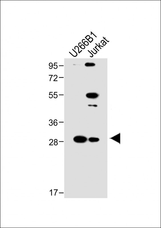 Rabbit Polyclonal Antibody to LAPTM5 (N-term)
