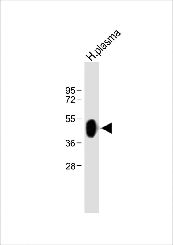 Rabbit Polyclonal Antibody to HP