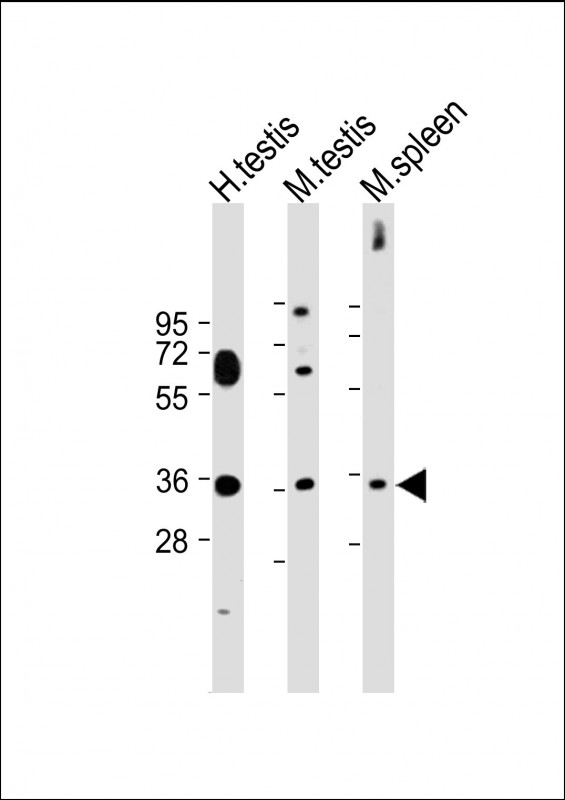 Rabbit Polyclonal Antibody to ASB17  (C-term)
