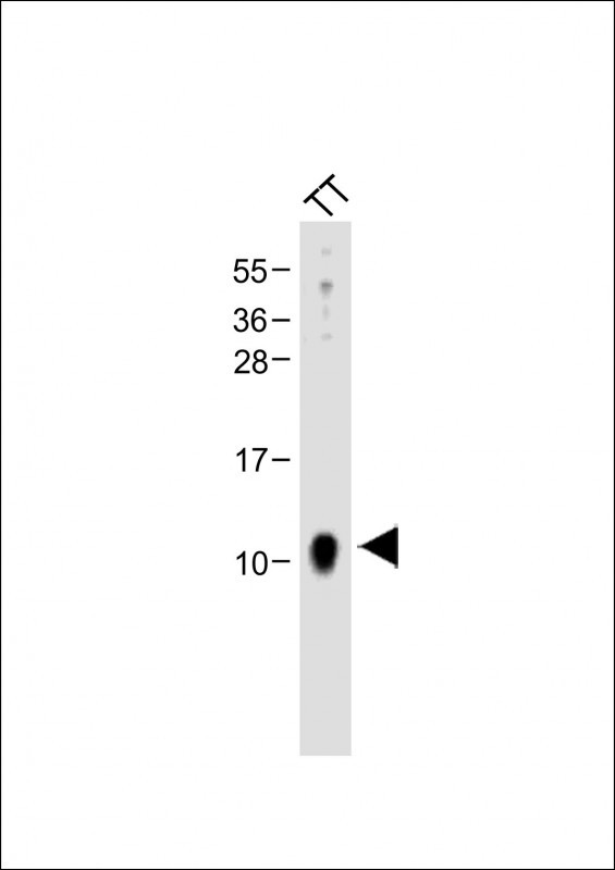 Rabbit Polyclonal Antibody to CALCA
