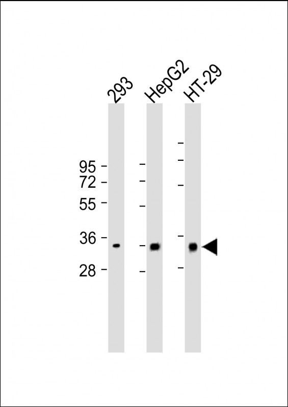 Rabbit Polyclonal Antibody to CLEC12B