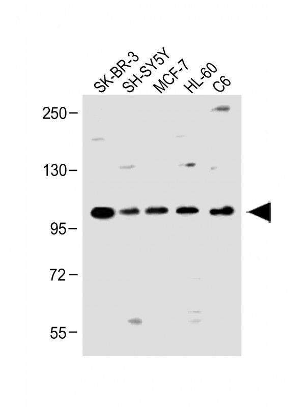Rabbit Polyclonal Antibody to PCDH20