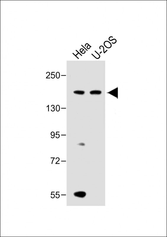 Rabbit Polyclonal Antibody to KDM6B (N-term)