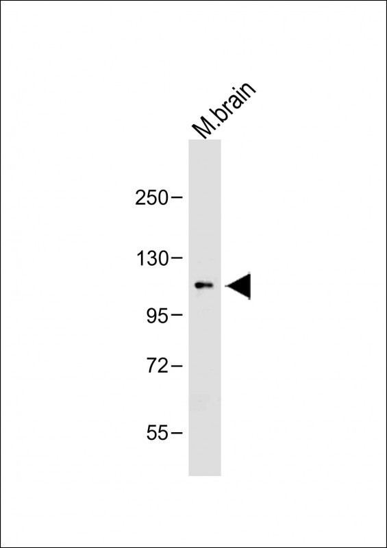 Rabbit Polyclonal Antibody to OTUD7A (N-term)