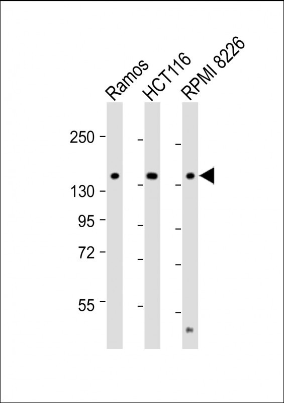 Rabbit Polyclonal Antibody to TIAM1