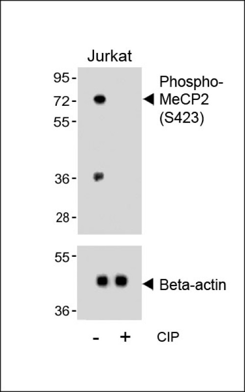 Rabbit Polyclonal Antibody to Phospho-MeCP2(S423)