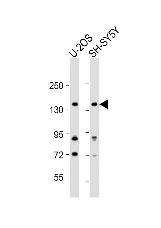 Rabbit Polyclonal Antibody to DGKK