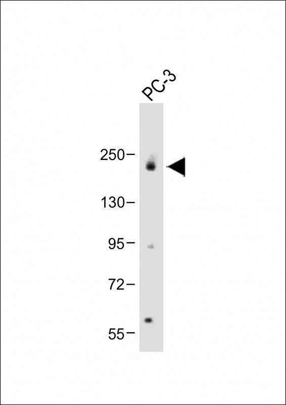 Rabbit Polyclonal Antibody to JLP (SPAG9) (N-term)