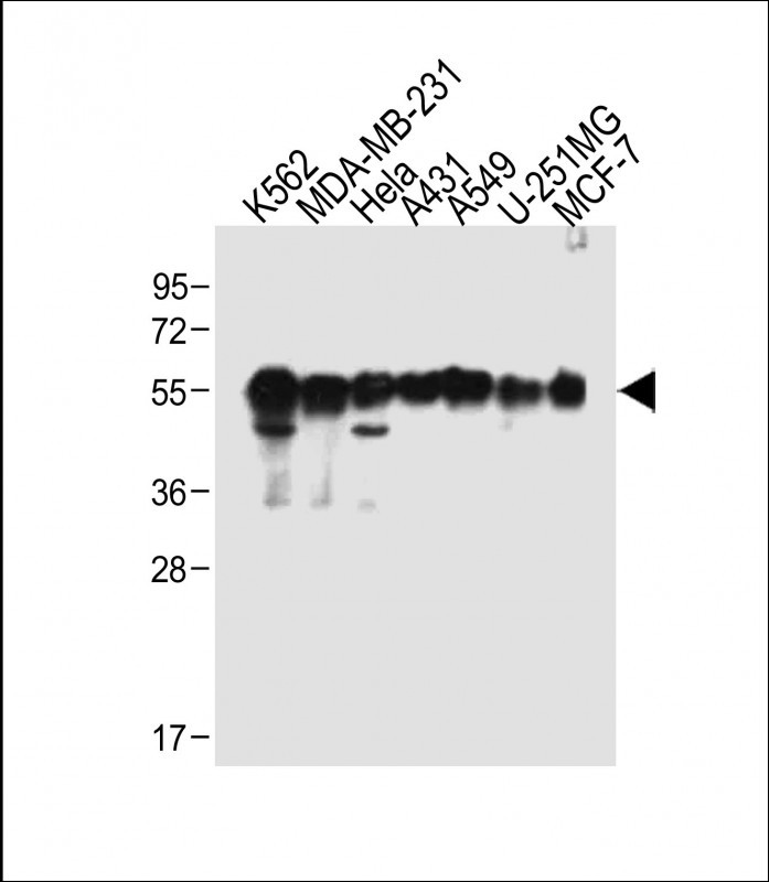 Rabbit Polyclonal Antibody to TUBB6