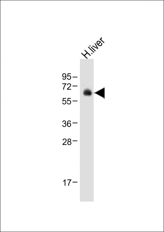 Rabbit Polyclonal Antibody to UGT2B15