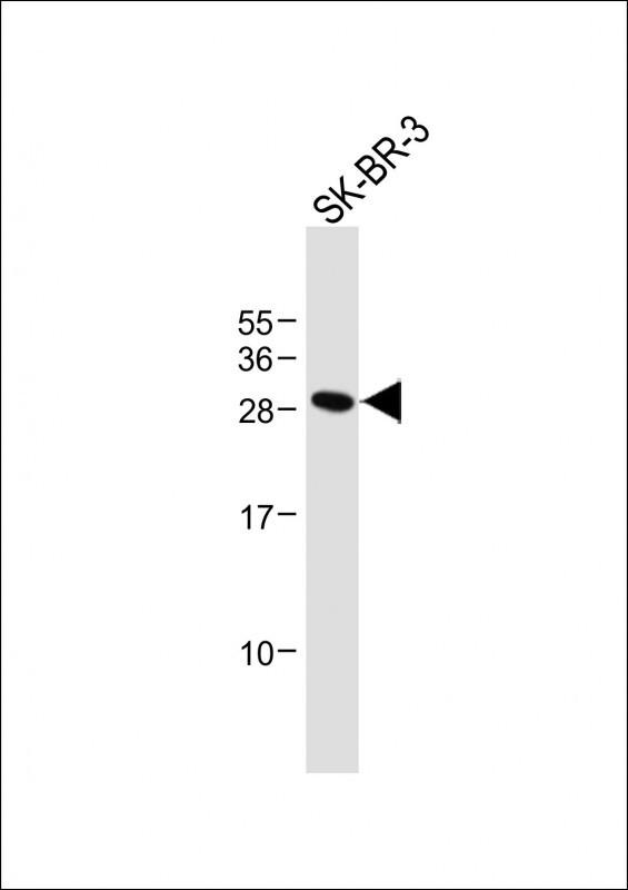Rabbit Polyclonal Antibody to WFDC1 (C-term H163)