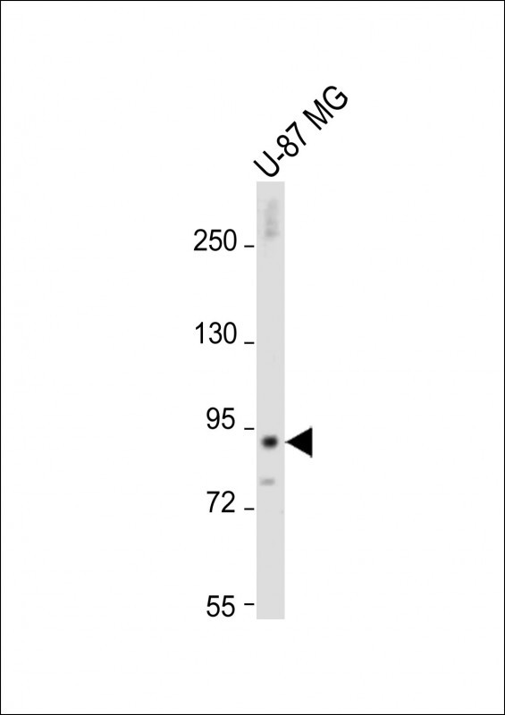 Rabbit Polyclonal Antibody to DTNA