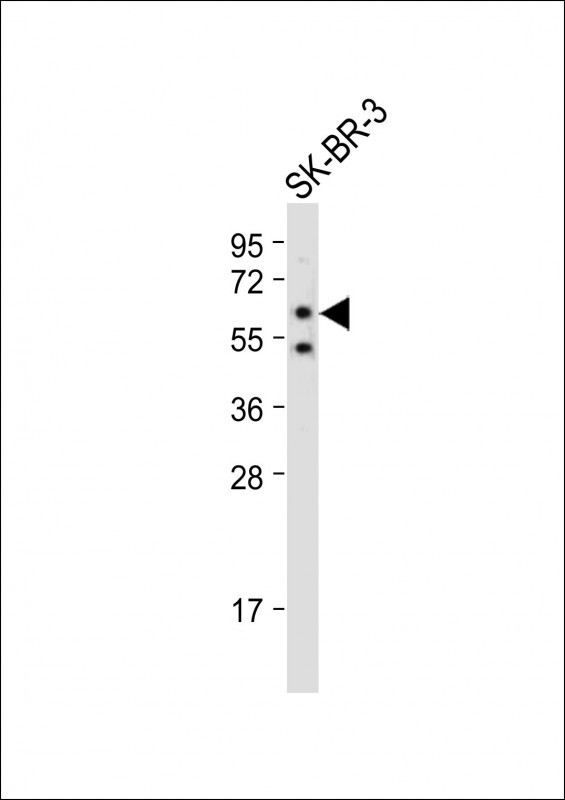 Rabbit Polyclonal Antibody to SLC15A3