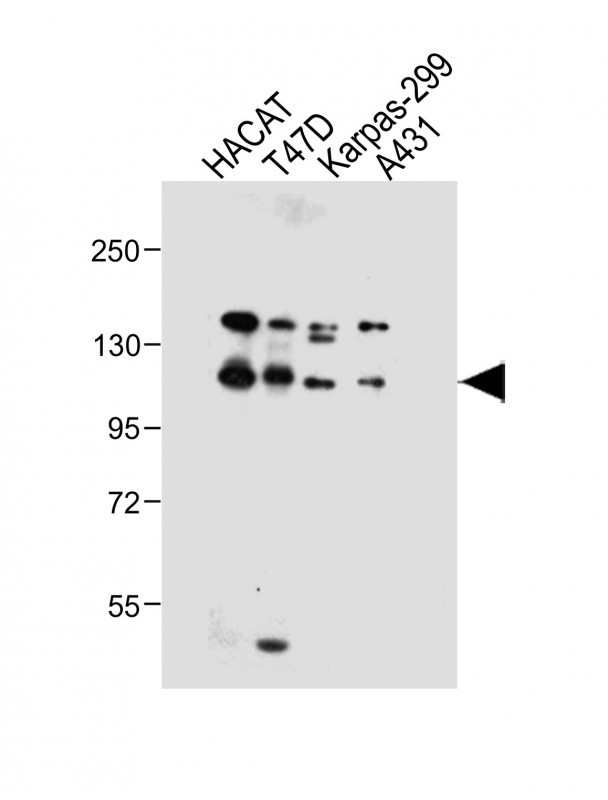 Rabbit Polyclonal Antibody to MMRN2