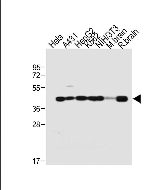 Rabbit Polyclonal Antibody to TARDBP (N-term)