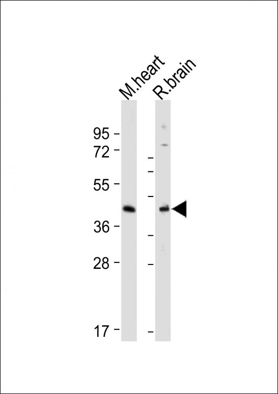 Rabbit Polyclonal Antibody to GPER