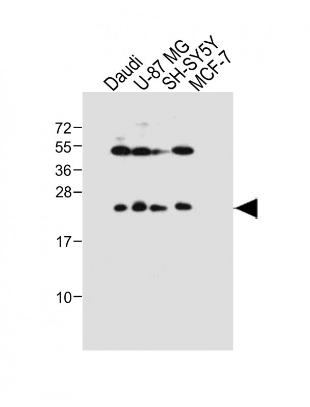Rabbit Polyclonal Antibody to PRL
